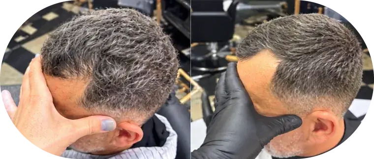 Antes e depois, cliente 2: à esquerda o antes, à direita o resultado