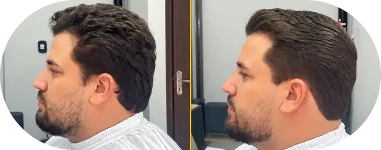 Antes e depois, cliente 4: à esquerda o antes, à direita o resultado