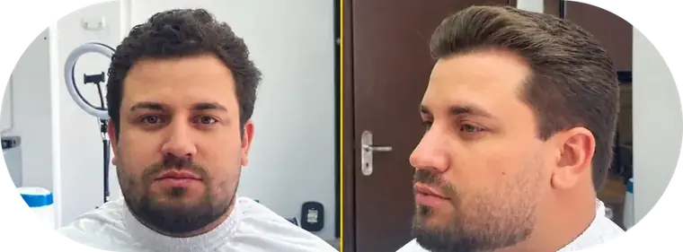 Antes e depois, cliente 5: à esquerda o antes, à direita o resultado