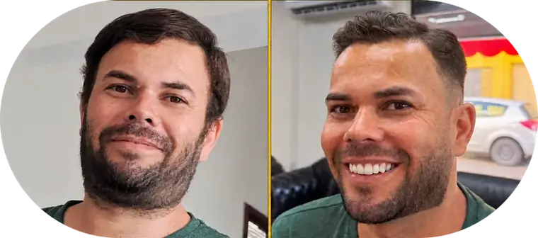 Antes e depois, cliente 6: à esquerda o antes, à direita o resultado